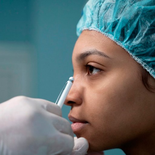 Rinoplastia – Plástica do Nariz