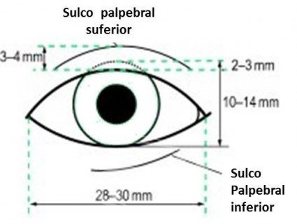 Medida da fenda palpebral média de 28-30mm